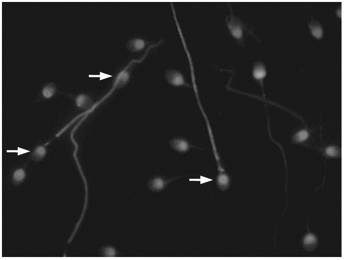 Detection kit and detection method of phosphorylation of sperm tyrosine