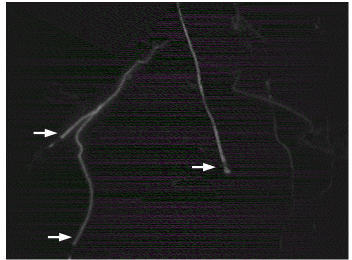 Detection kit and detection method of phosphorylation of sperm tyrosine