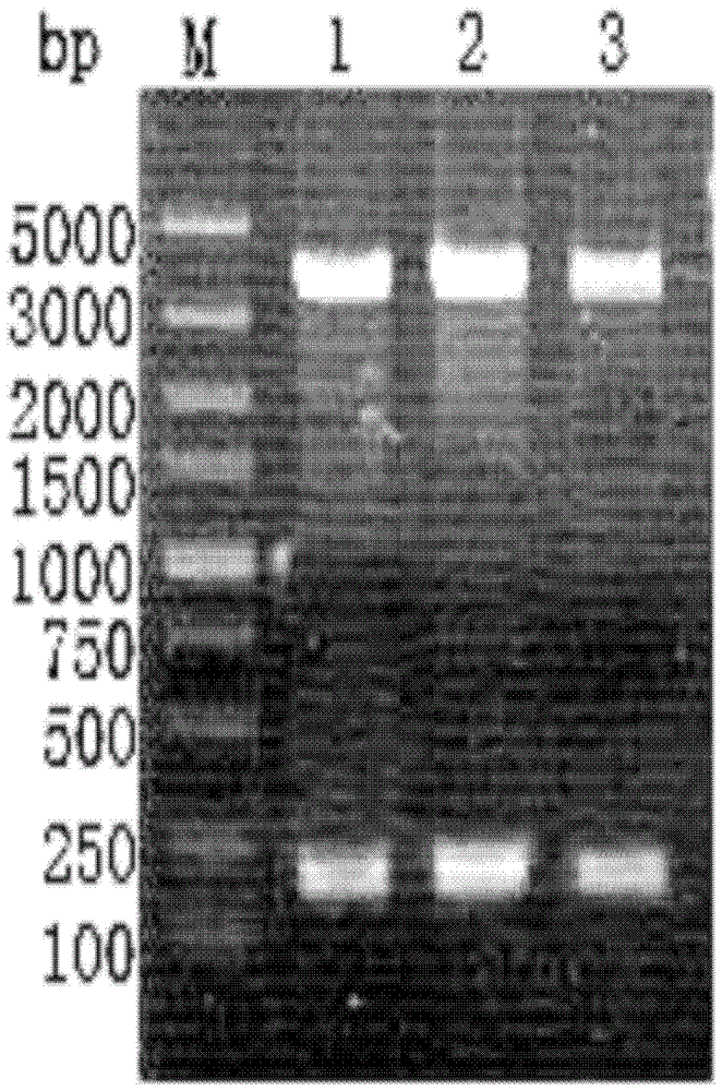 Optimization and high-level expression of insulin aspart precursor gene