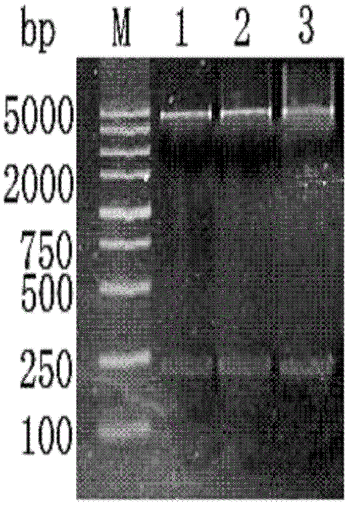 Optimization and high-level expression of insulin aspart precursor gene