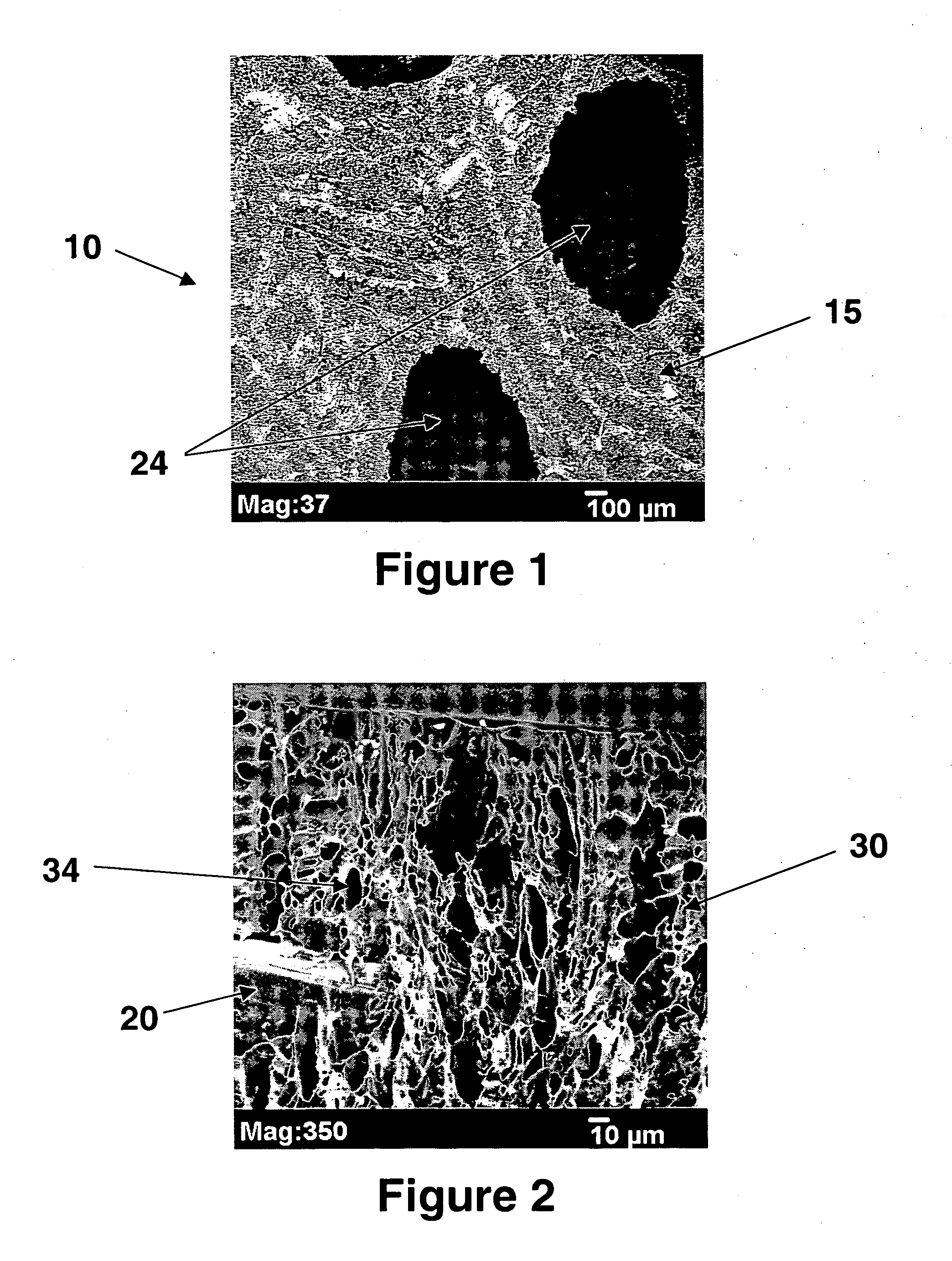 Device for tissue reinforcement having microporous and macroporous structures