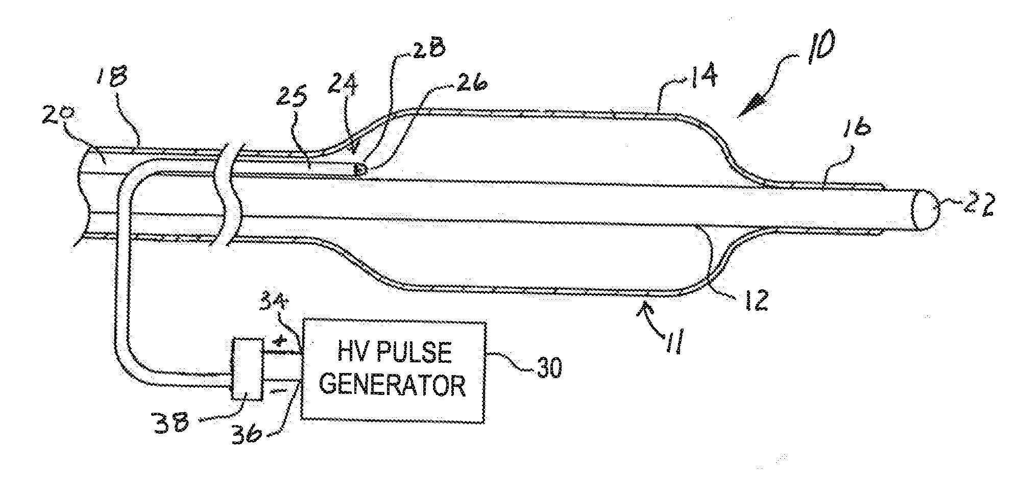 Shock wave catheter system with arc preconditioning