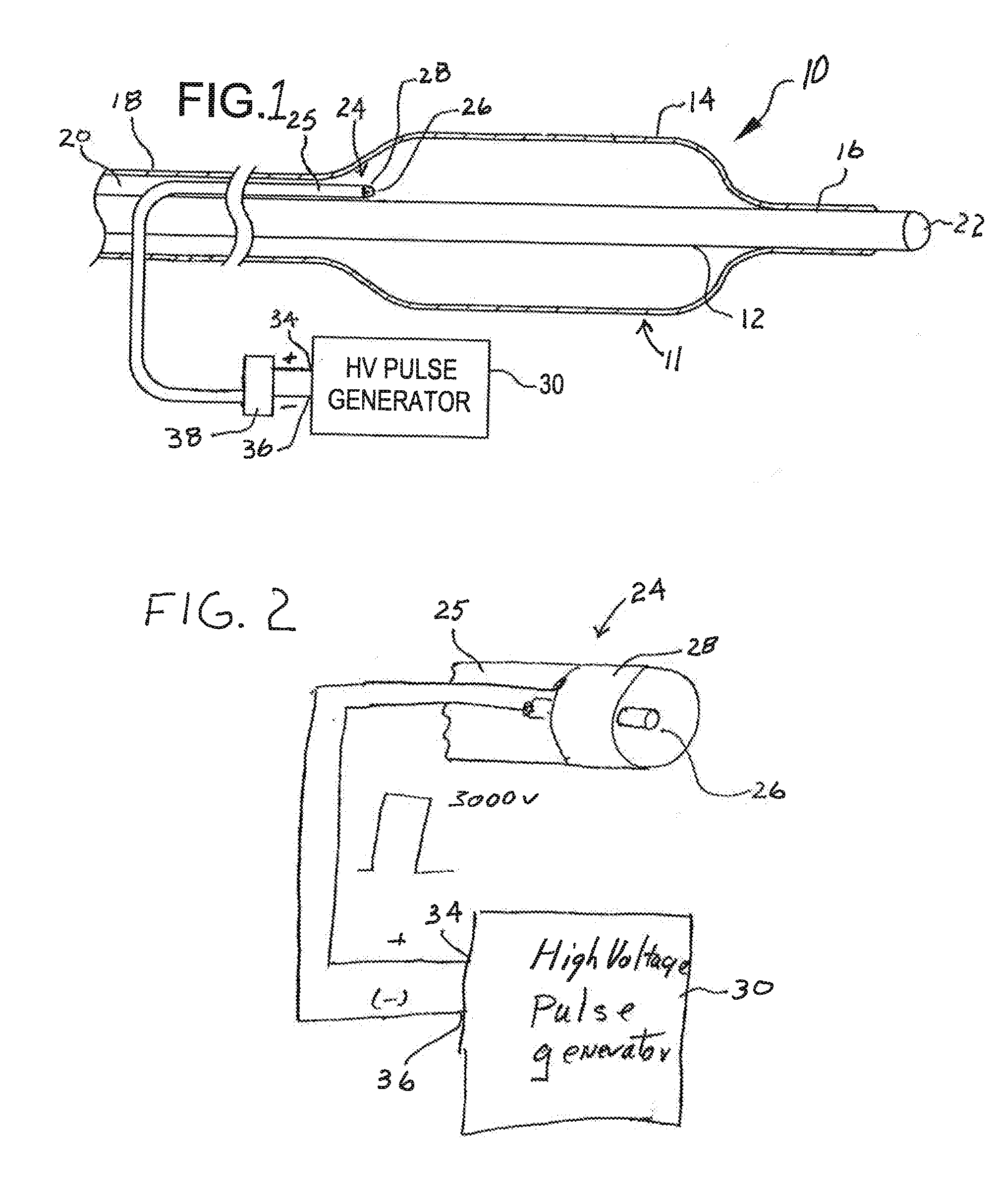 Shock wave catheter system with arc preconditioning