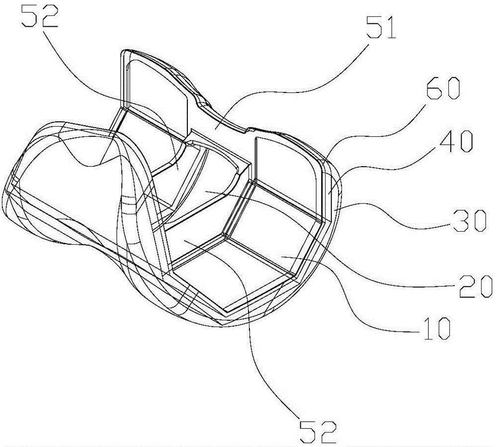 Femur condyles prosthesis component