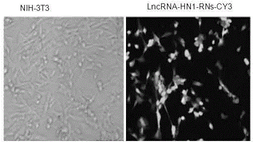 Preparation and application of long non-coding RNA (ribonucleic acid) nanometer microsphere