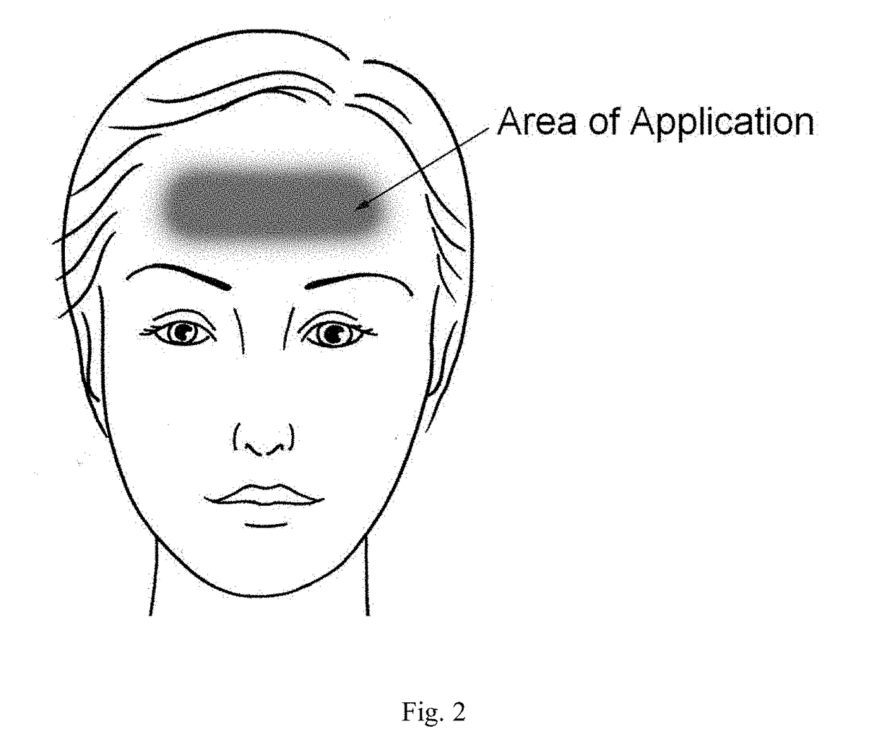 Treatment of symptoms related to neurodegenerative disorders through pharmacological dermal activation of cranial nerves