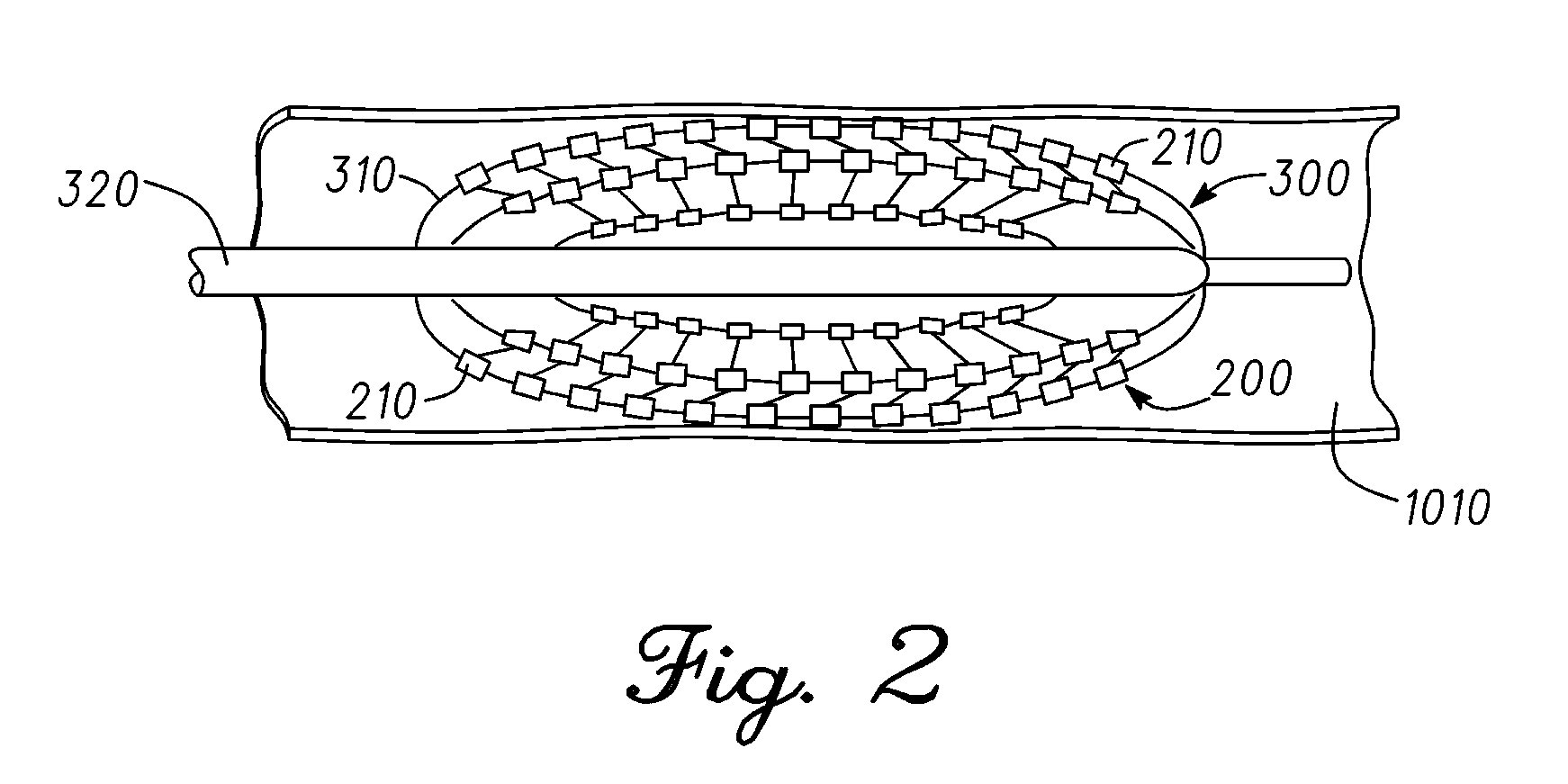 Catheter balloon having stretchable integrated circuitry and sensor array