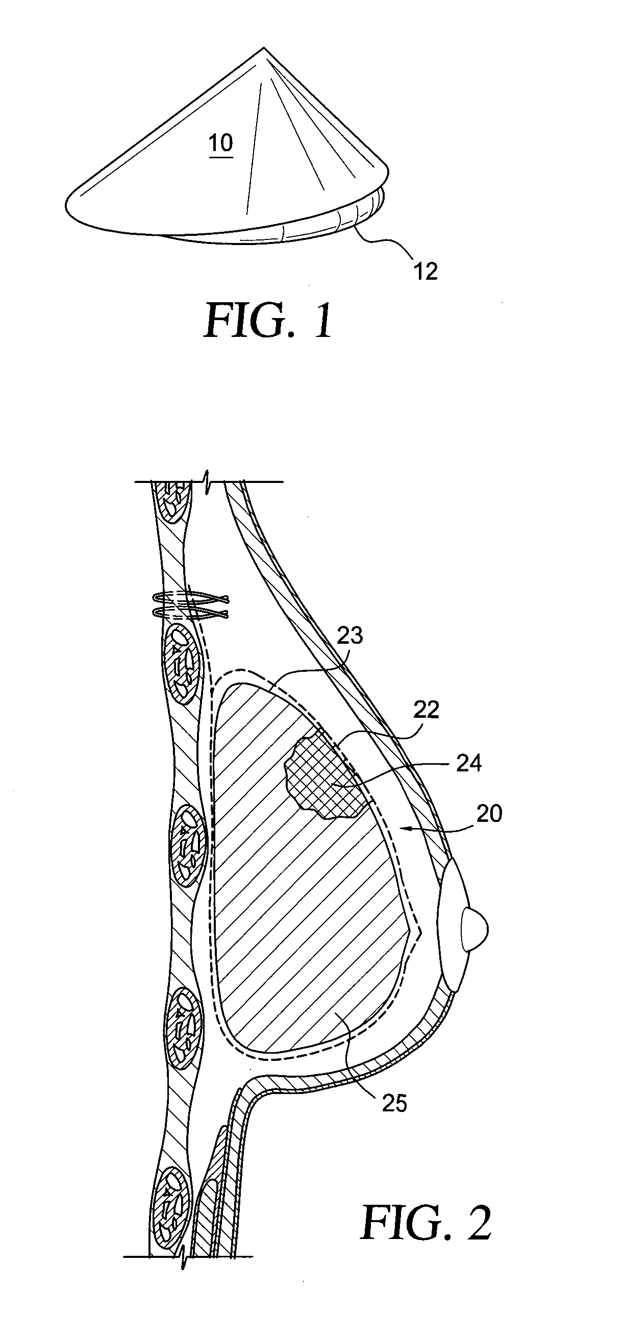 Self supporting implant in a human body and method for making the same without capsular contracture