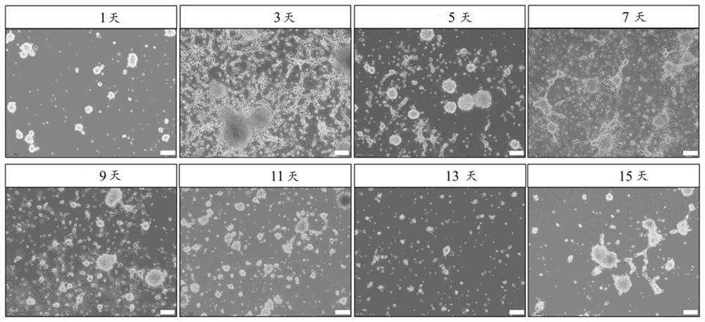 Method for differentiating neural stem cells into oligodendroglia cells, culture medium and application