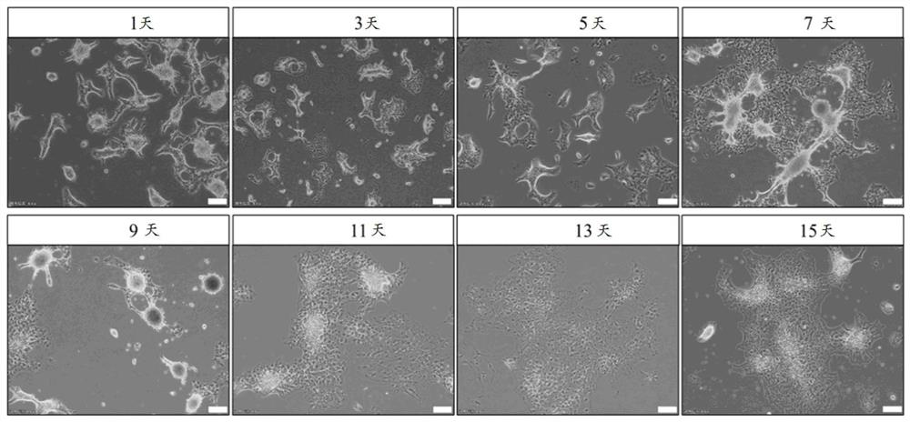 Method for differentiating neural stem cells into oligodendroglia cells, culture medium and application