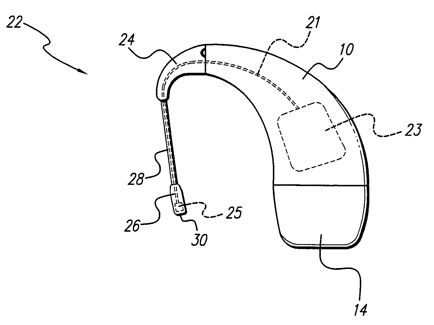 Method of constructing an in the ear auxiliary microphone for behind the ear hearing prosthetic