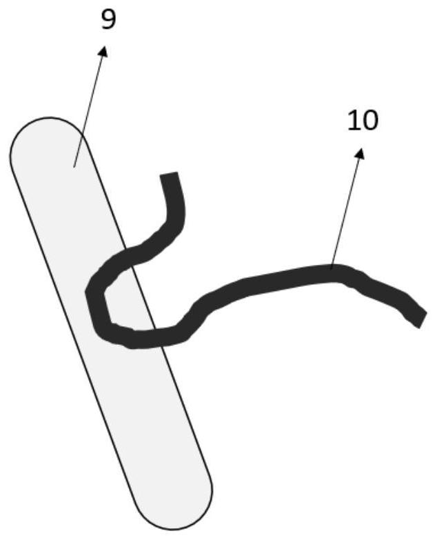 Microcatheters for Microvascular Nerve Decompression