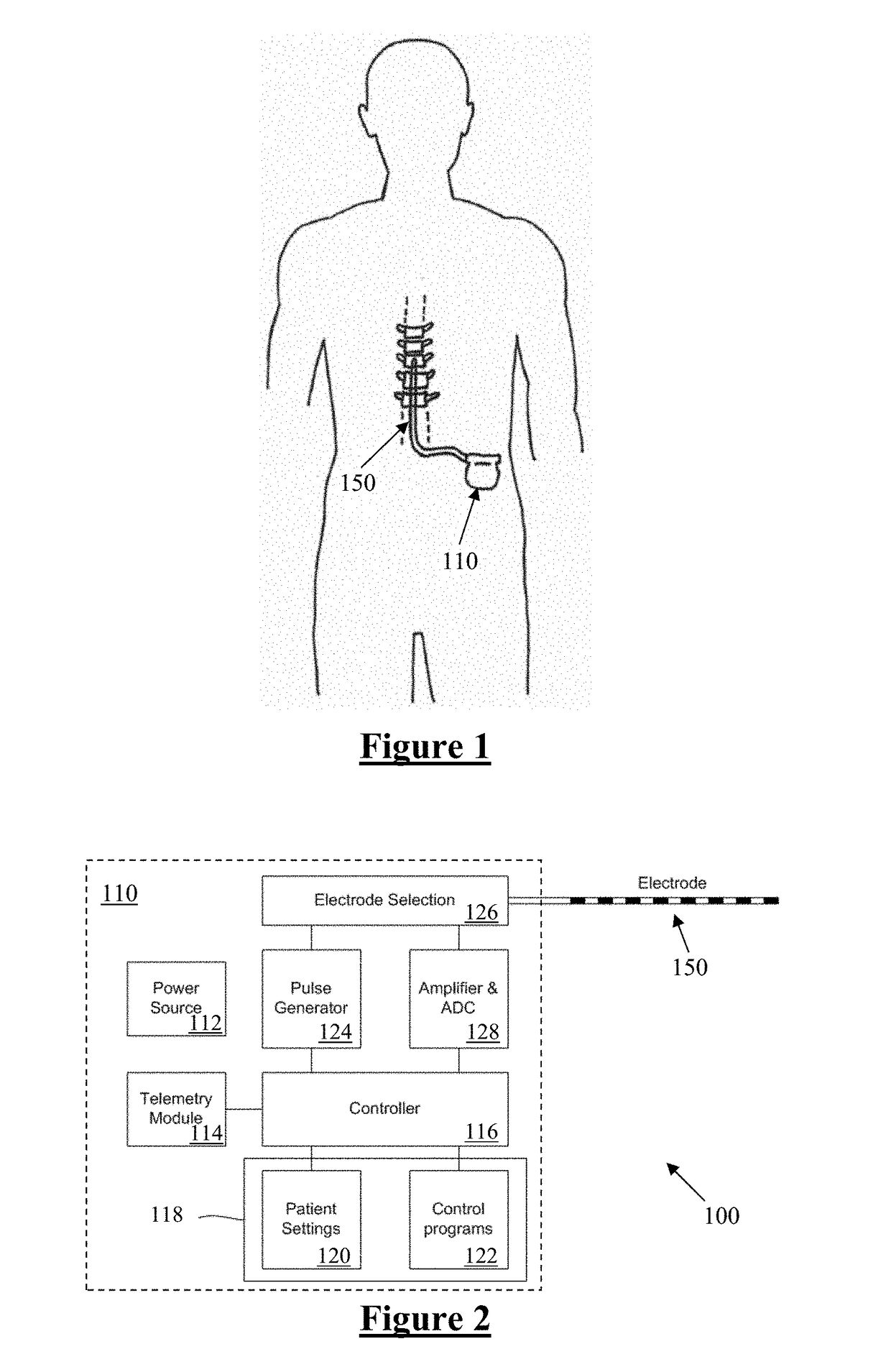 Method and Device for Feedback Control of Neural Stimulation