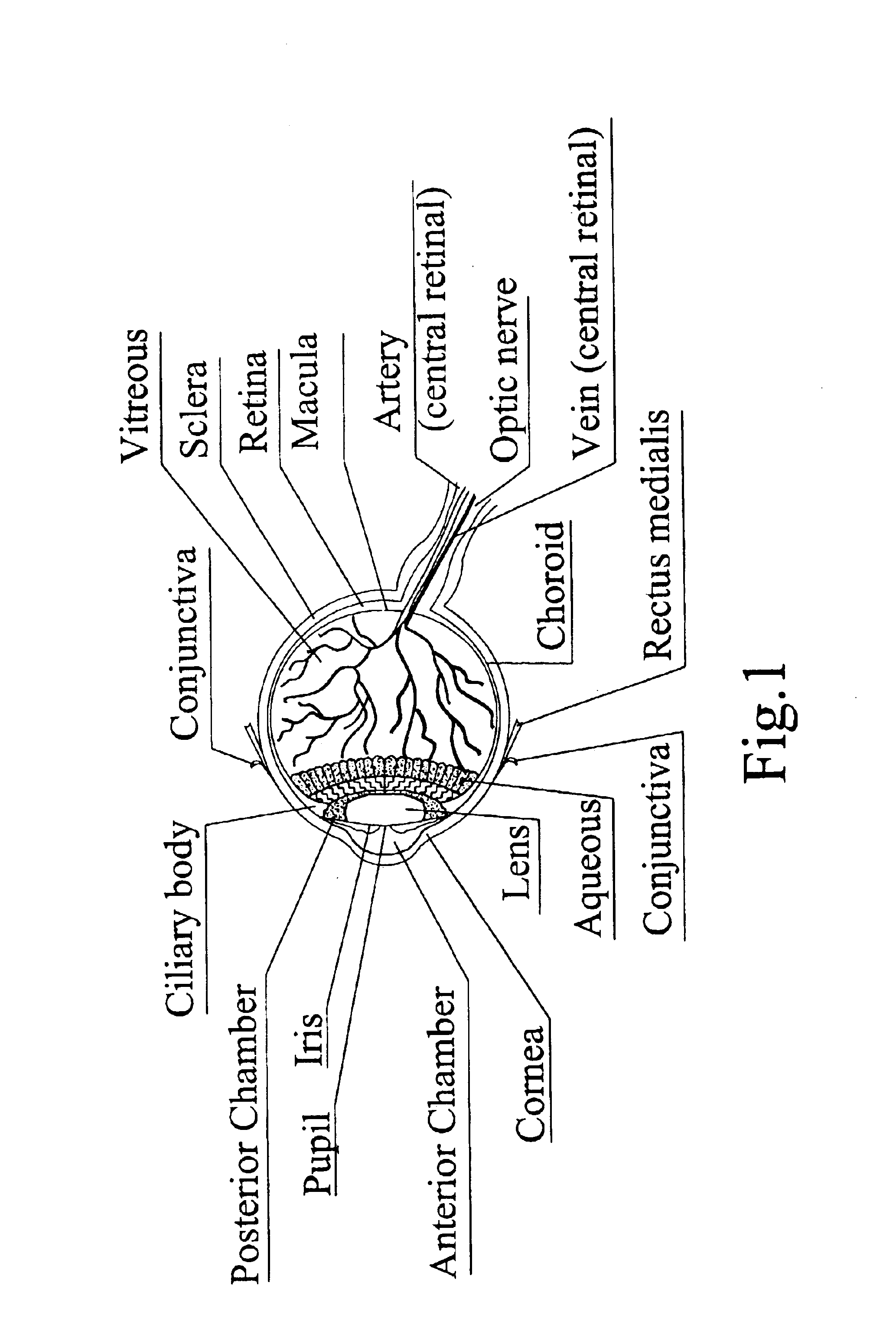 Optical device for intraocular observation