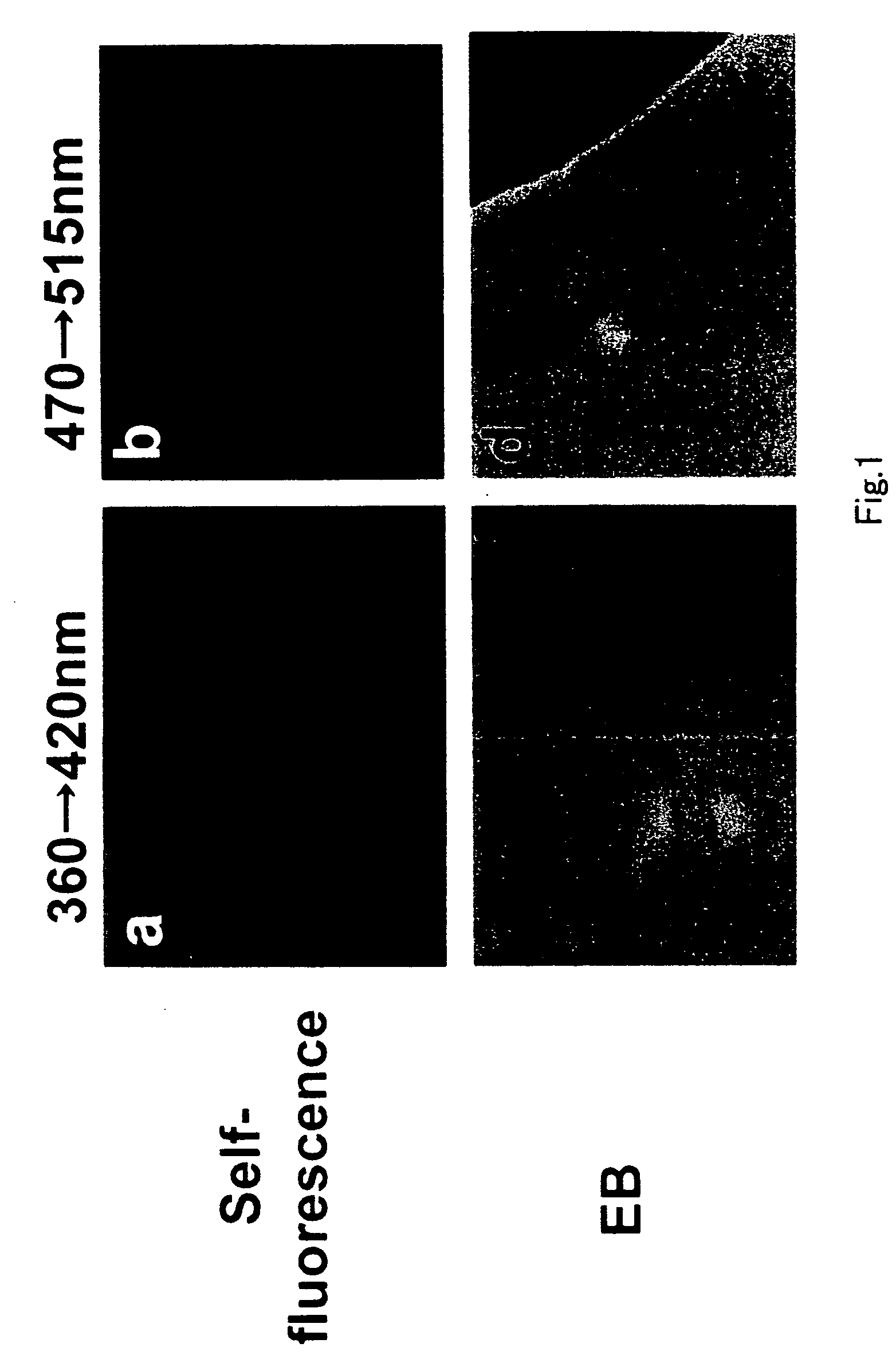 Medicine for detecting lipid components in vivo and vascular endoscope