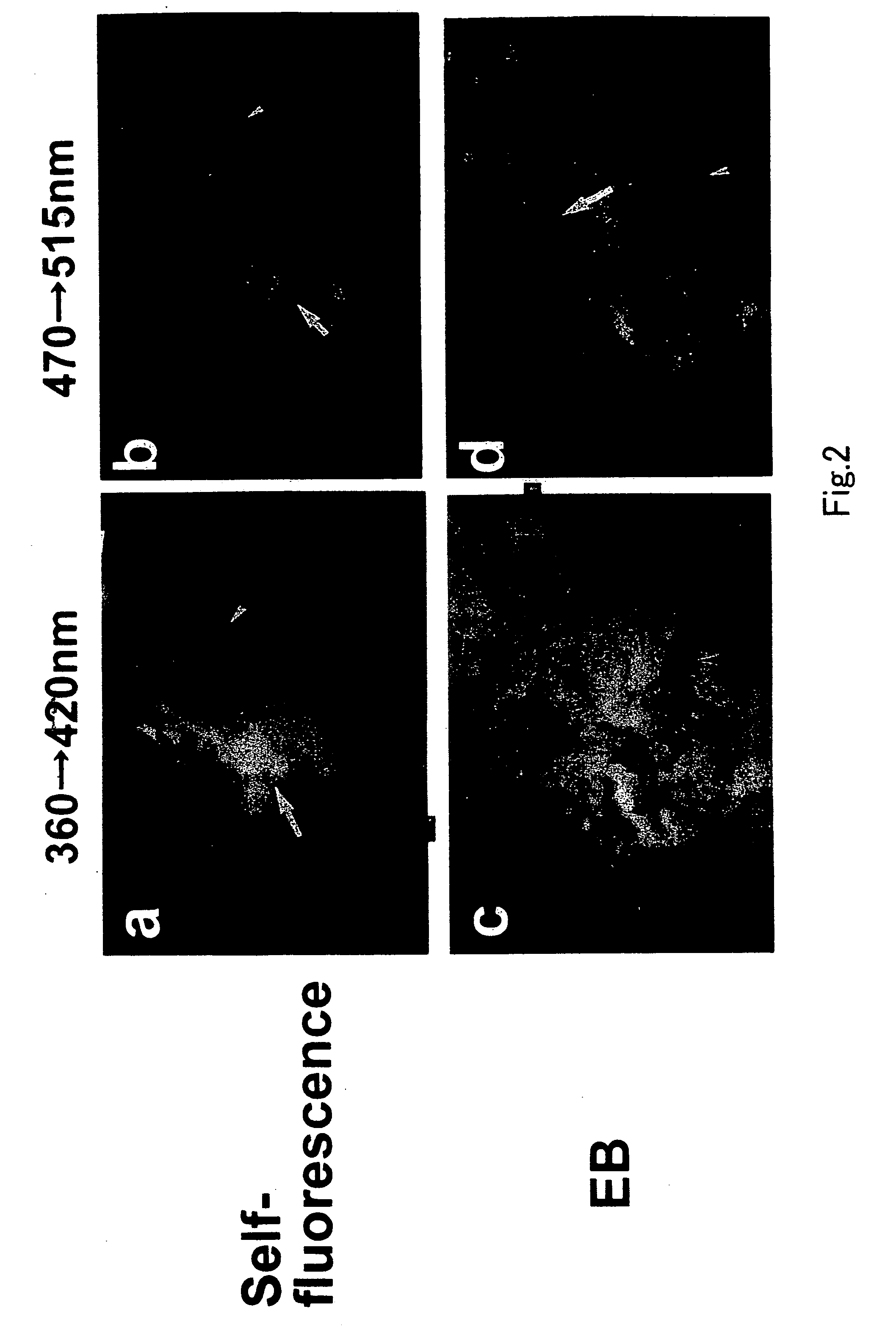 Medicine for detecting lipid components in vivo and vascular endoscope