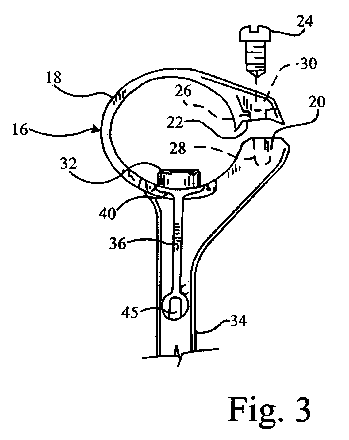Multi-prong conversion tine for a harvester reel and method
