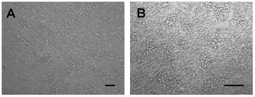 Highly aggressive human acute b lymphocytic leukemia cell line with add(11)(q23) chromosomal abnormality