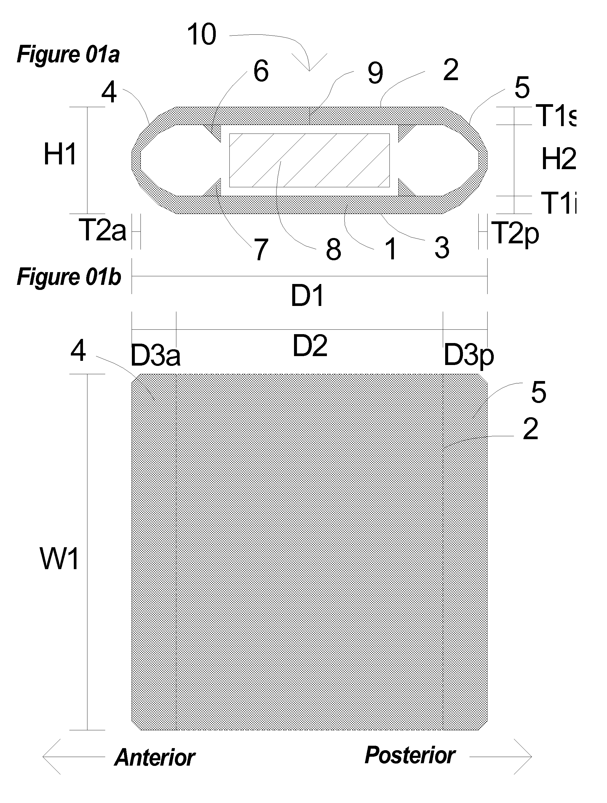 Method, apparatus, surgical technique, surgical tools, and materials for minimally invasive enhanced fusion and restoration of kinematically physiologic spinal movement
