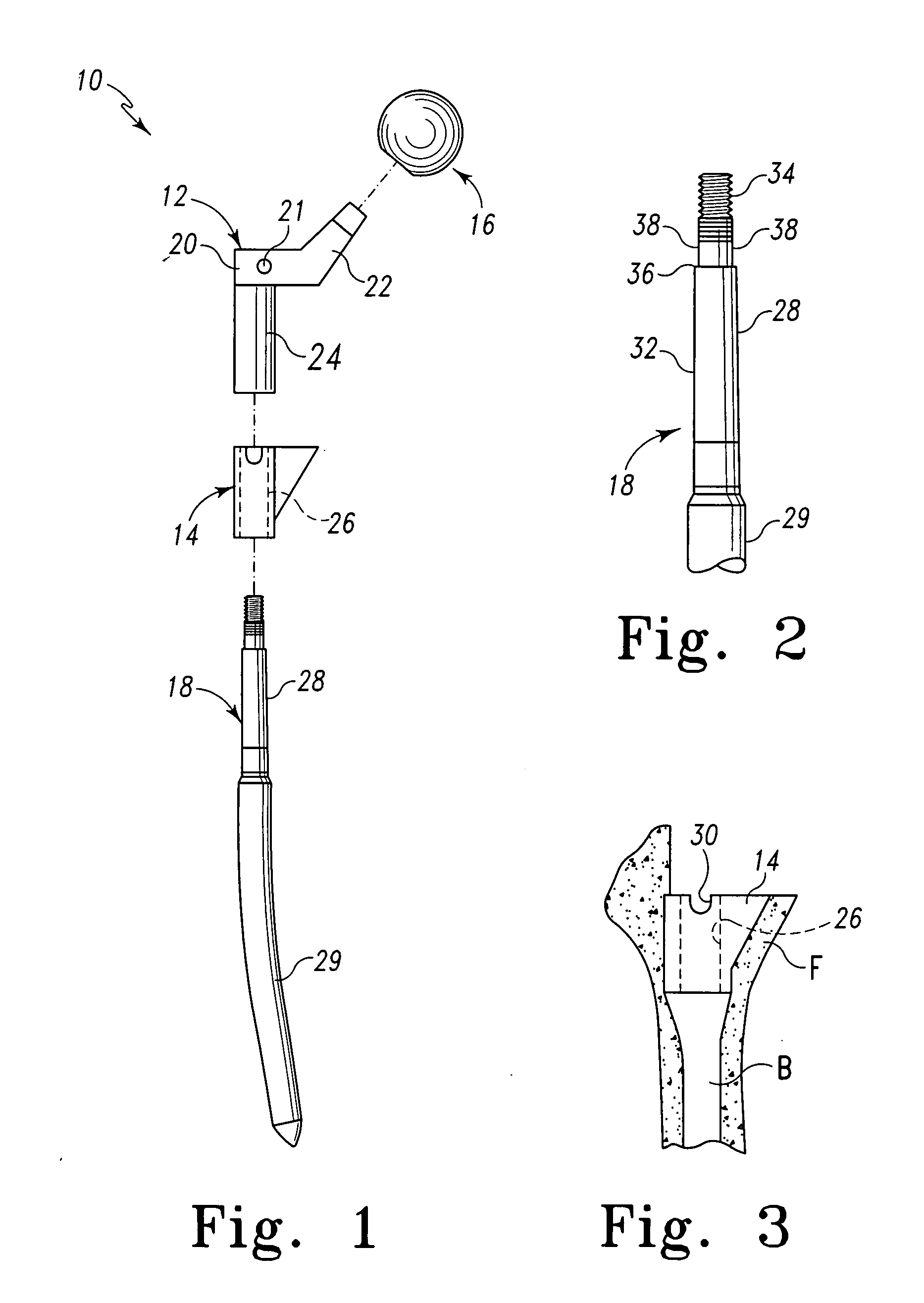 Trialing system and method for modular hip joint replacement system