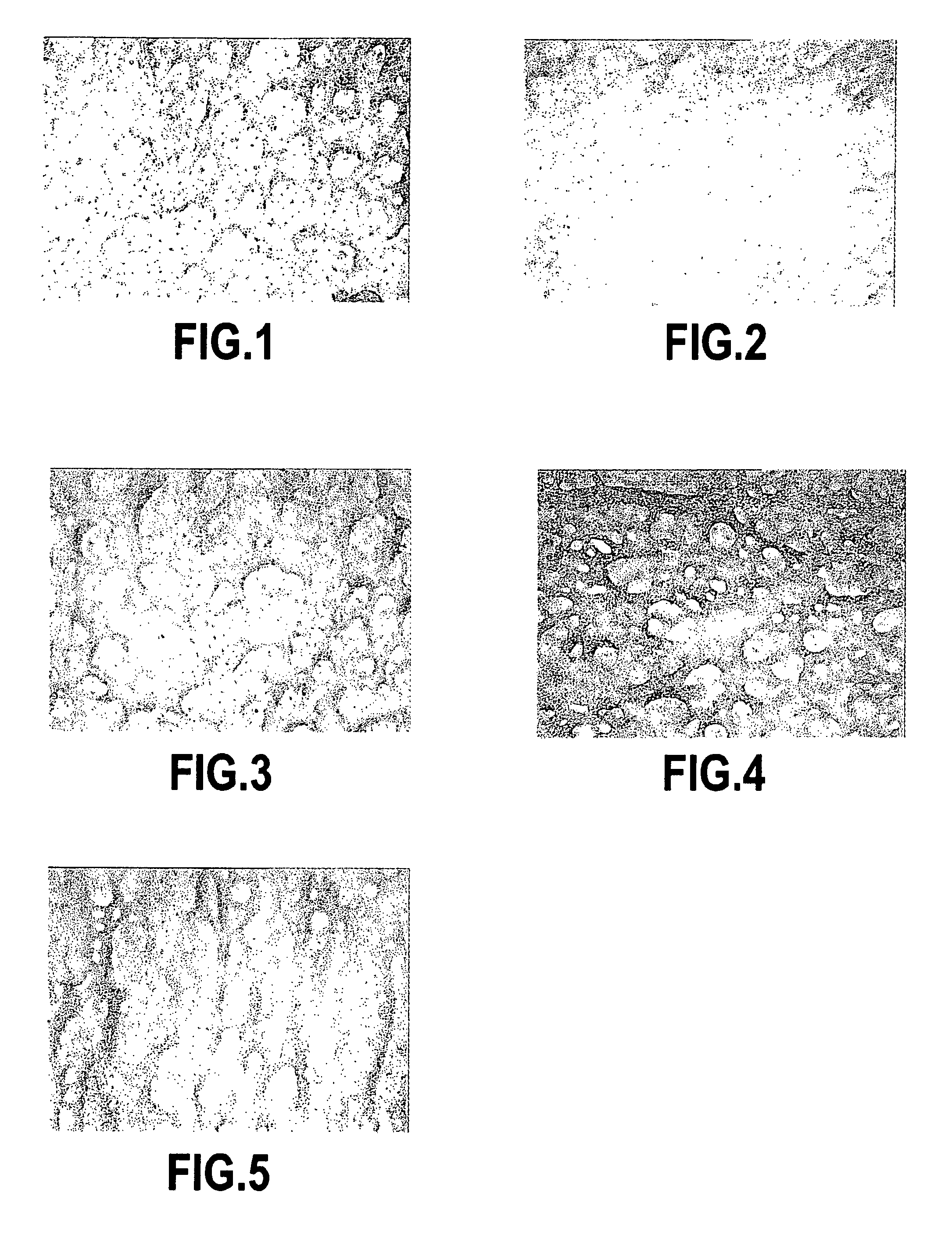 Use of L 2-thiohistidine or one of its derivatives as a depigmenting agent in cosmetics