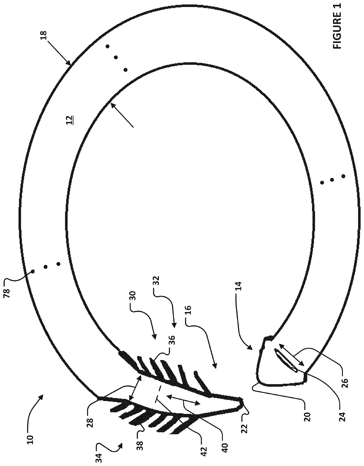 Corneal prosthesis and method of penetrating keratoplasty