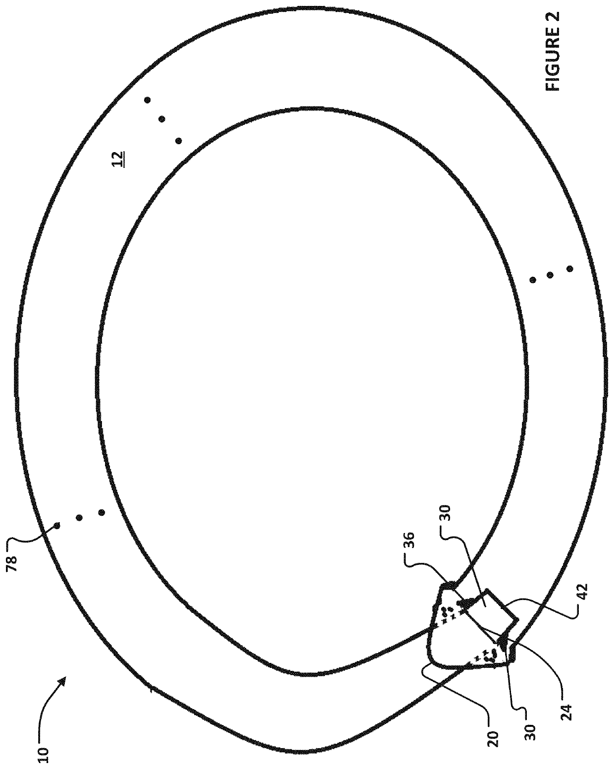 Corneal prosthesis and method of penetrating keratoplasty