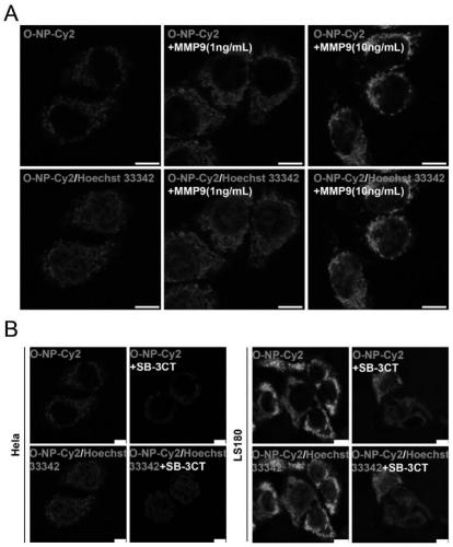 Tumor microenvironment responsive surface charge reversible nano-drug delivery carrier