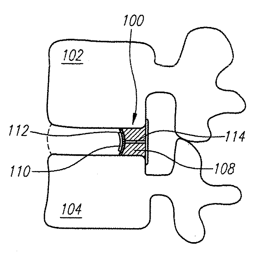 Annular repair devices and methods