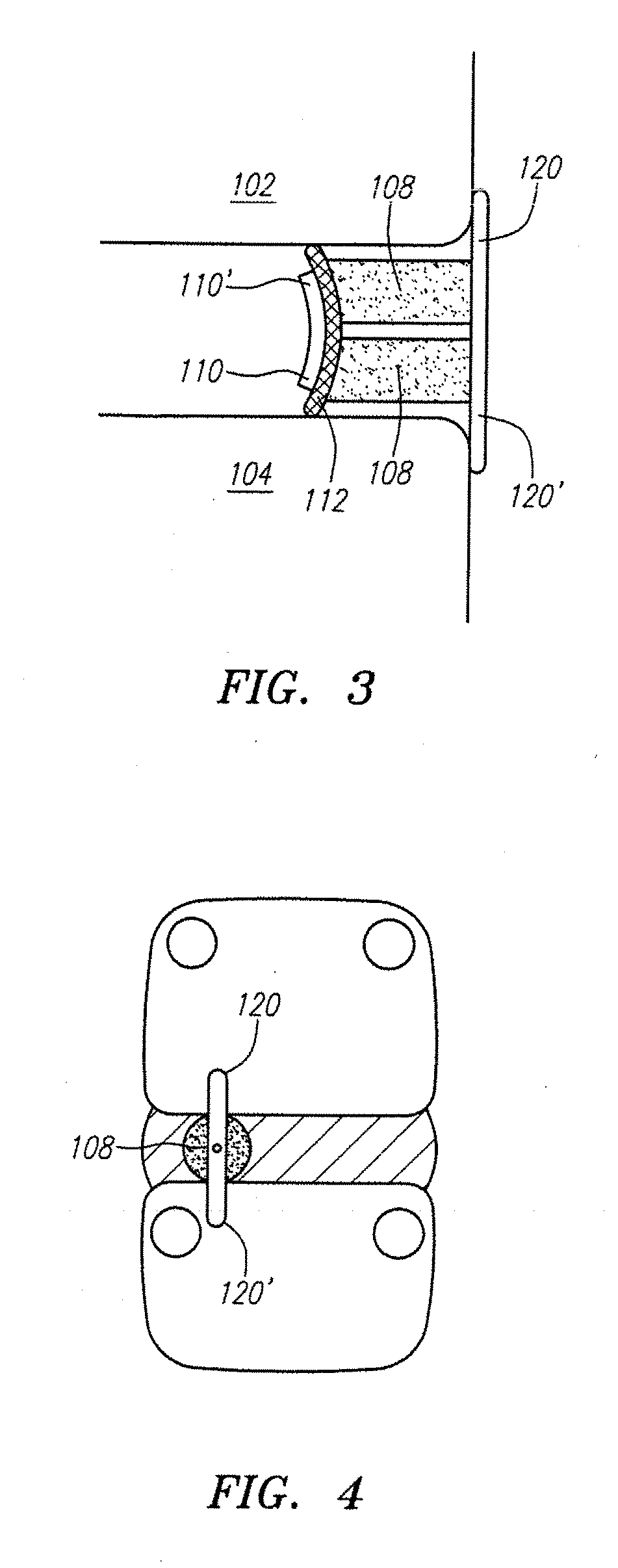 Annular repair devices and methods