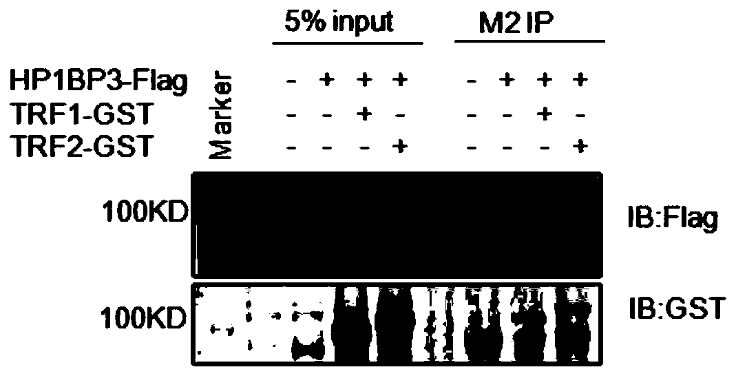 Application of telomere binding protein HP1BP3 in preparation of tumor cell regulator