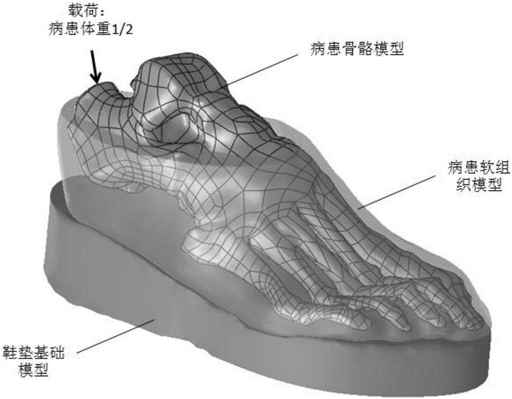Individualized design method for diabetic foot shoe pad