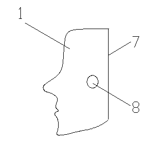 Eyelash cutting and lacrimal passage irrigation technique nursing teaching model in ophthalmology