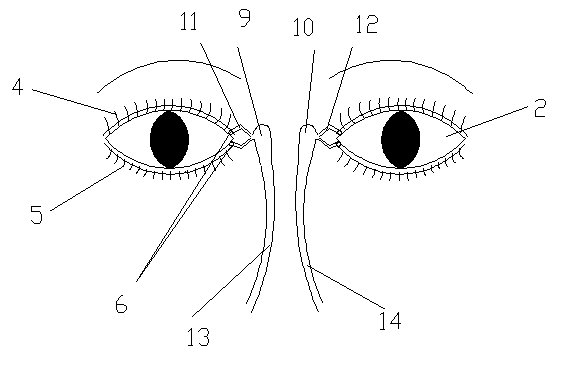 Eyelash cutting and lacrimal passage irrigation technique nursing teaching model in ophthalmology