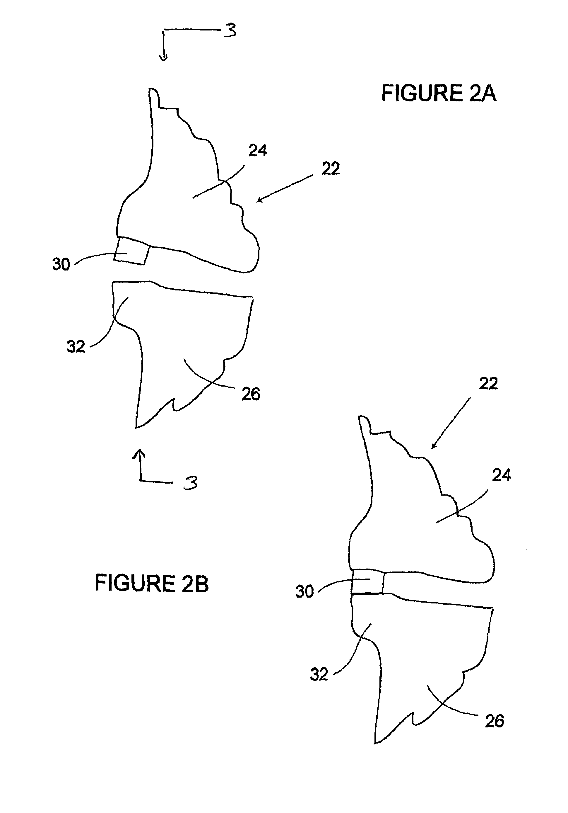 Methods of making and using an ankle-foot orthosis