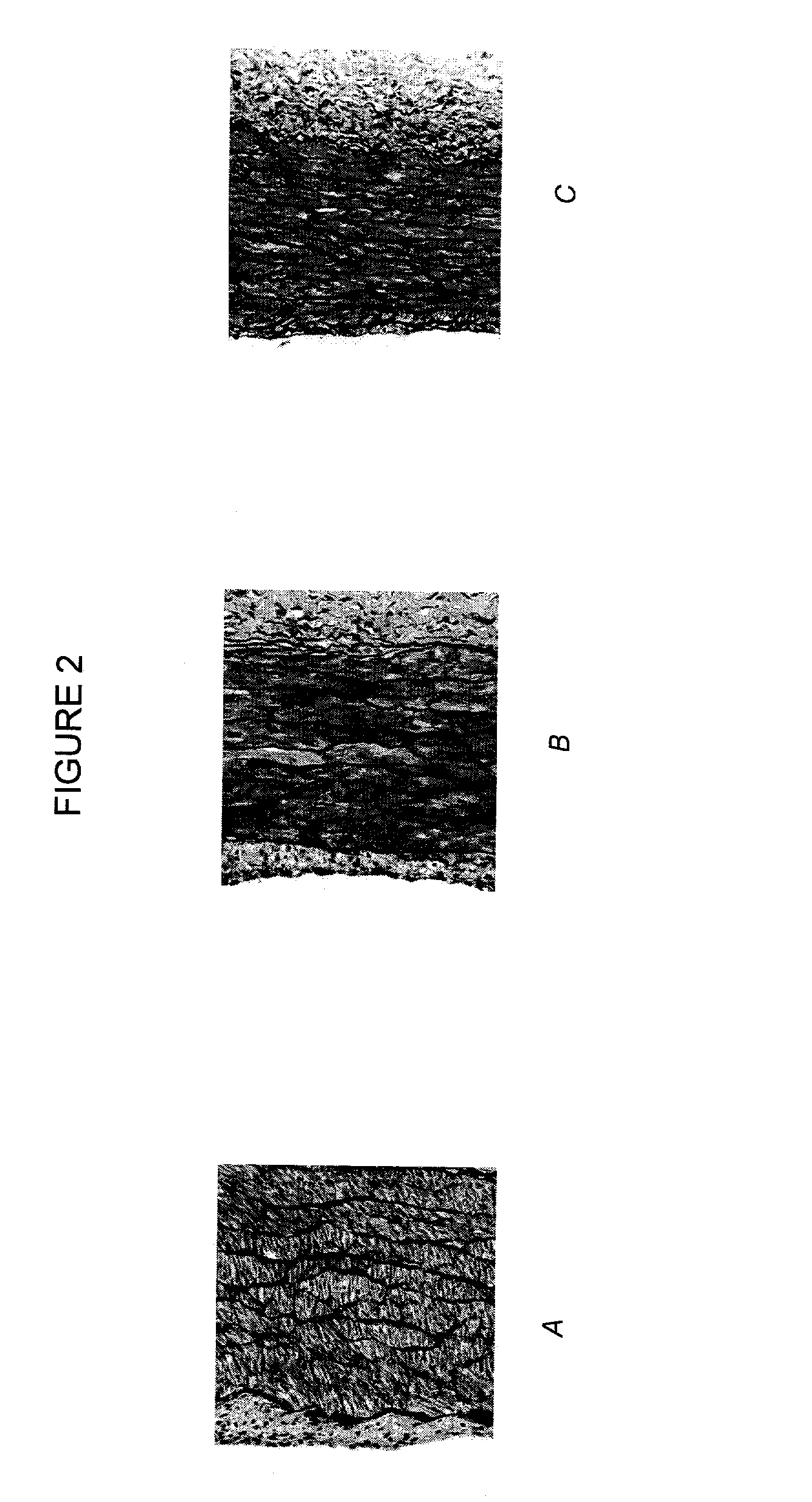 Methods for the inhibition of neointima formation
