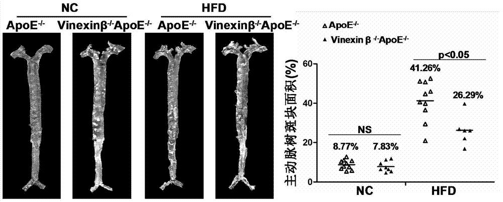 Function and application of Vinexin[beta] in treatment of atherosclerosis