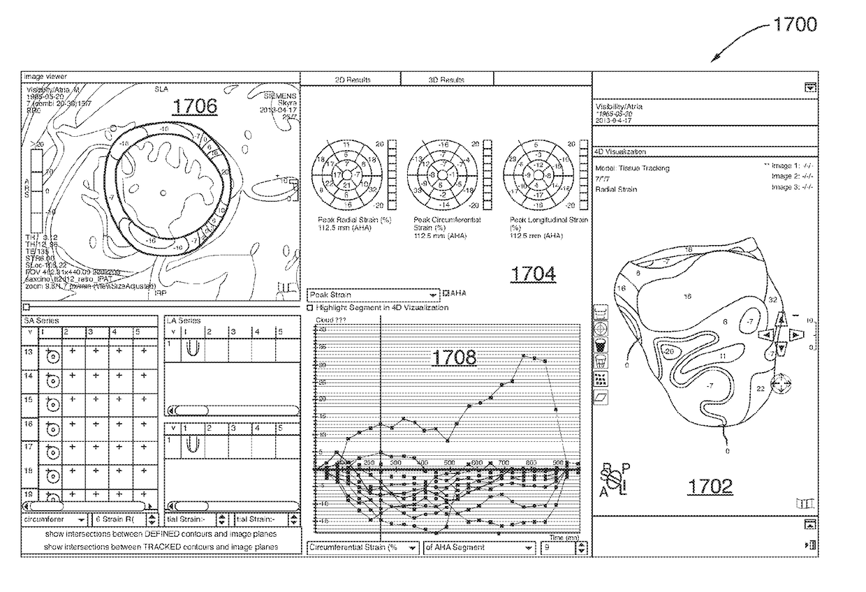 Method and System for Analysis of Myocardial Wall Dynamics