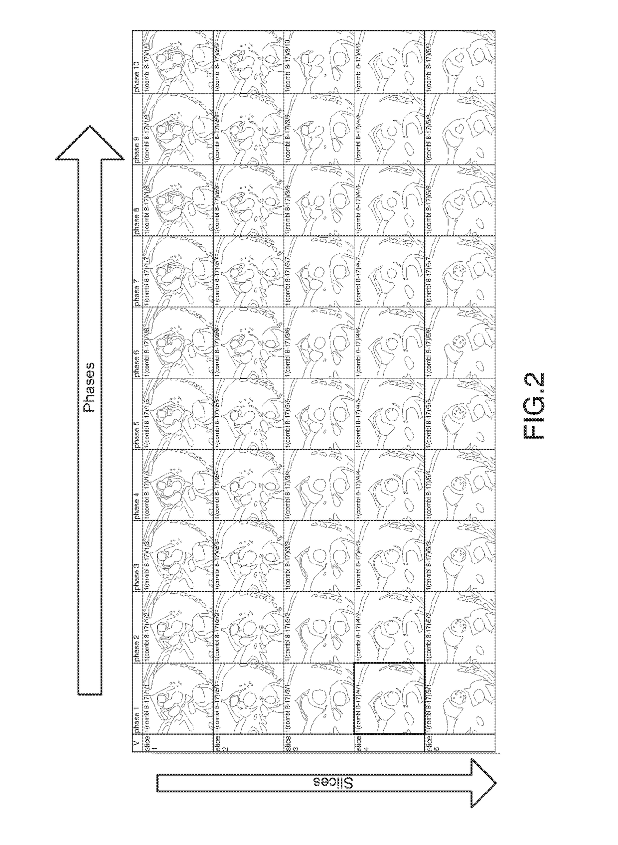 Method and System for Analysis of Myocardial Wall Dynamics