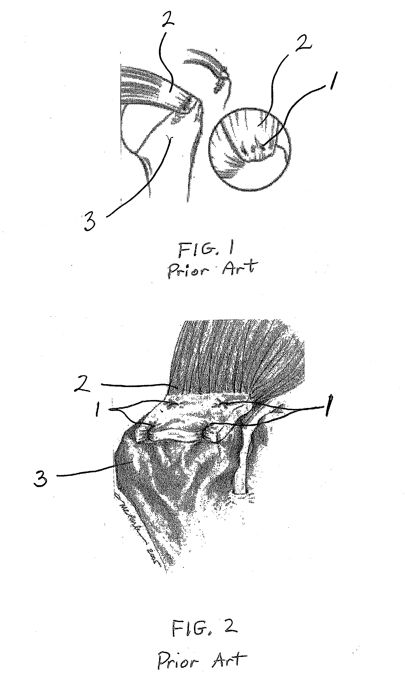 Systems and methods for repairing soft tissues using nanofiber material