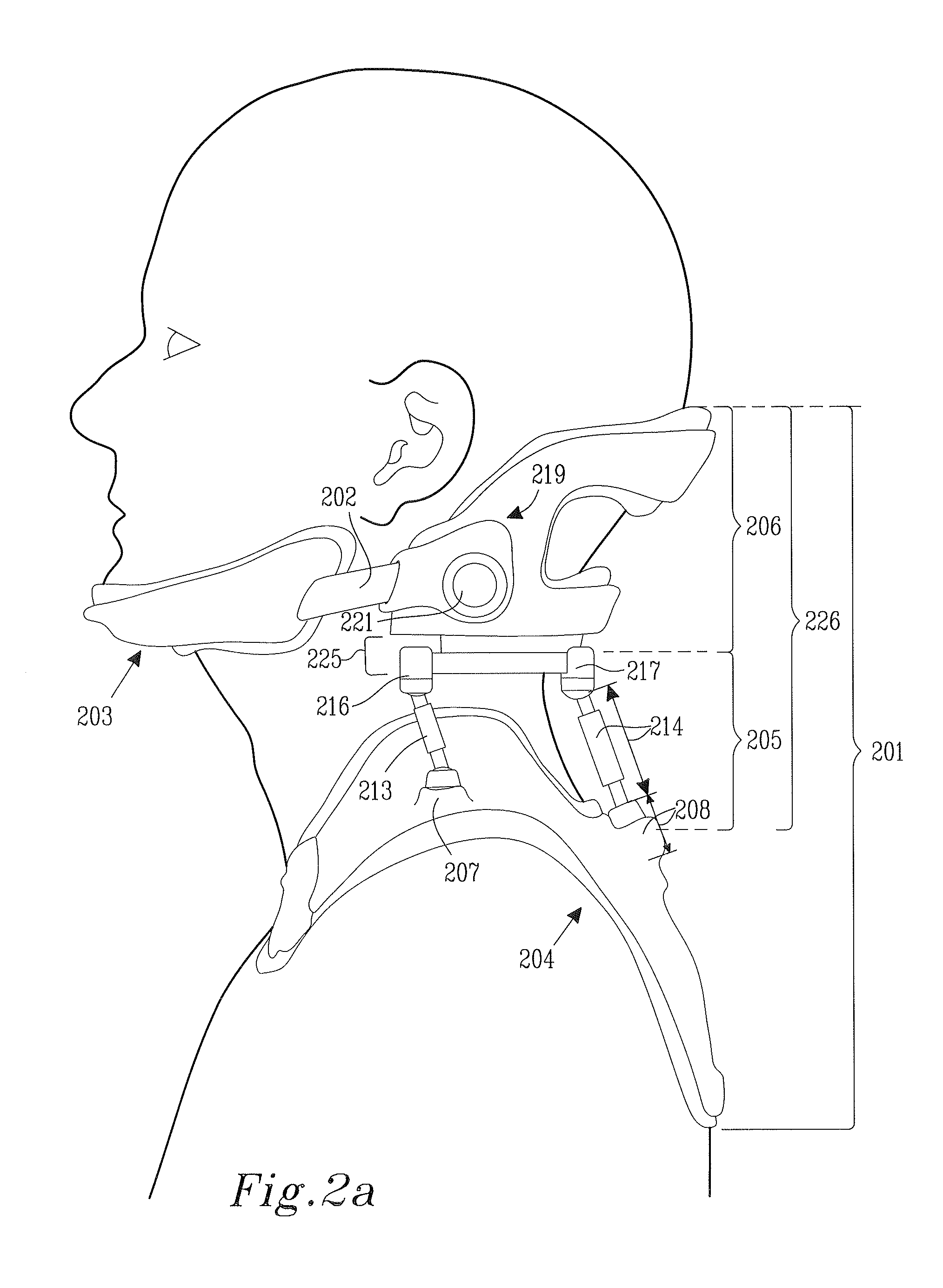 Mobilizing neck support device