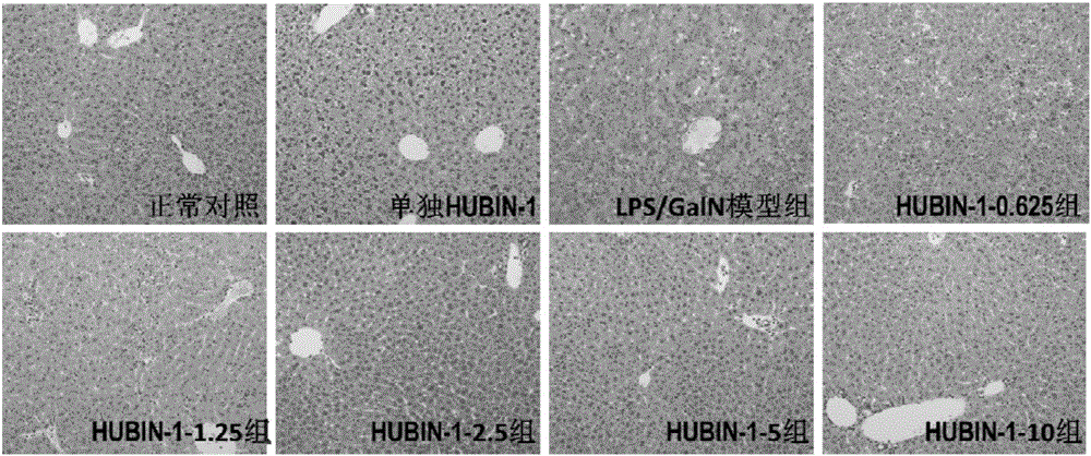 Application of compound HUBIN-1 in preparation of drug for preventing and/or treating liver inflammatory diseases