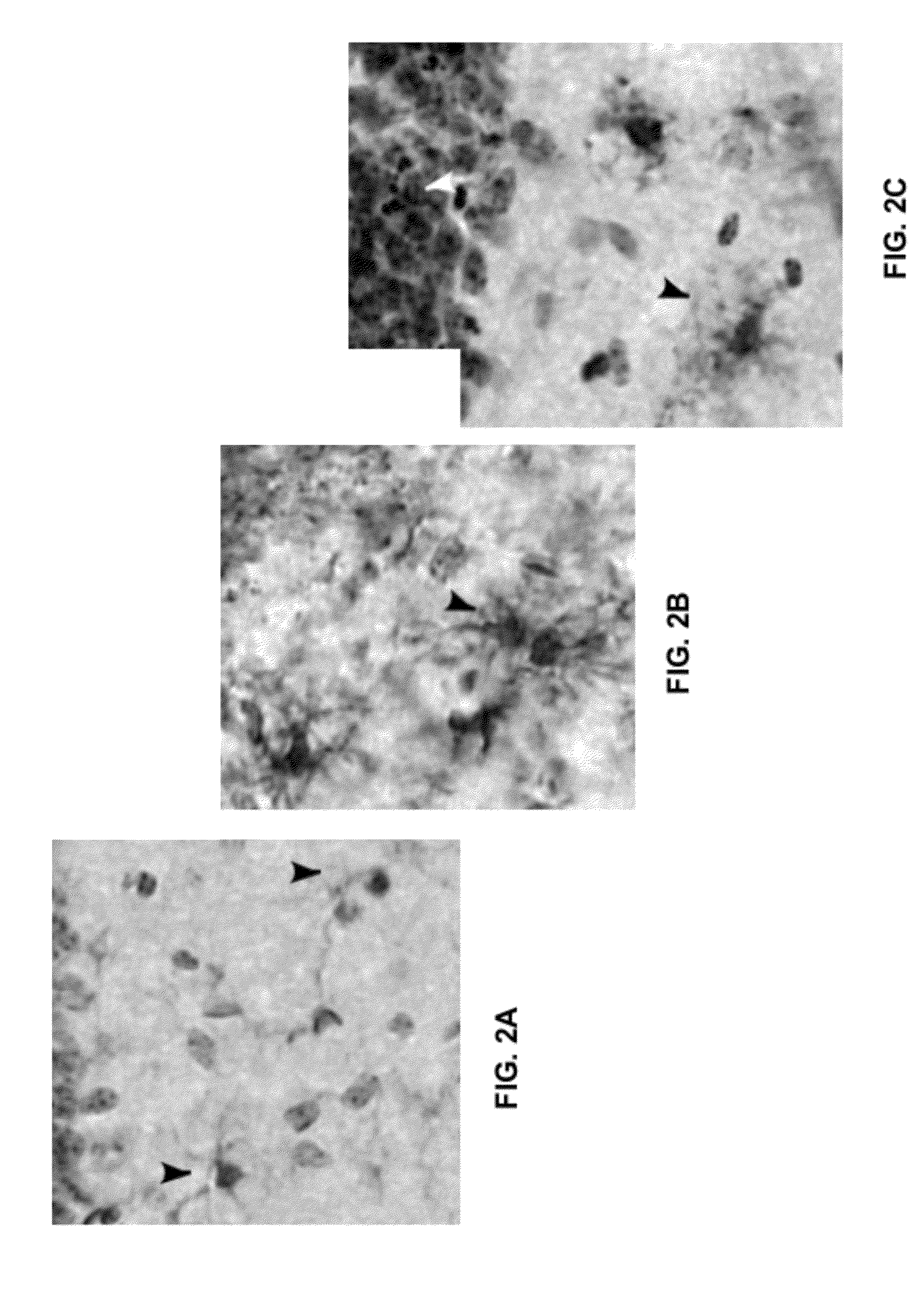 Modulation of Nad+ Activity in Neuropathophysiological Conditions and Uses Thereof