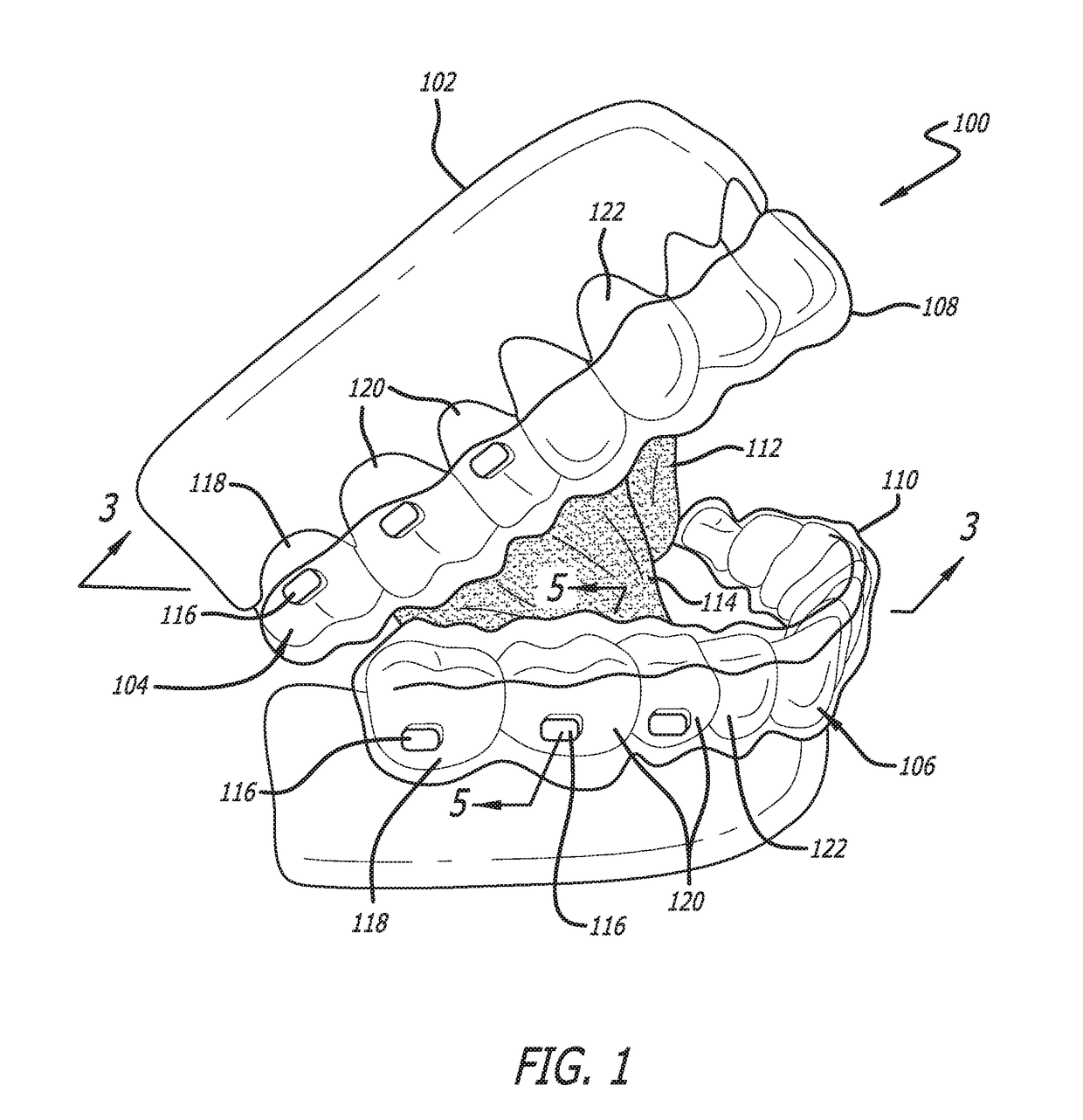 Oral weight control device