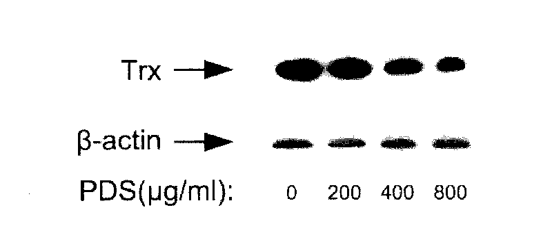 Antineoplastic drug taking panaxadiol saponins as active ingredient and application thereof