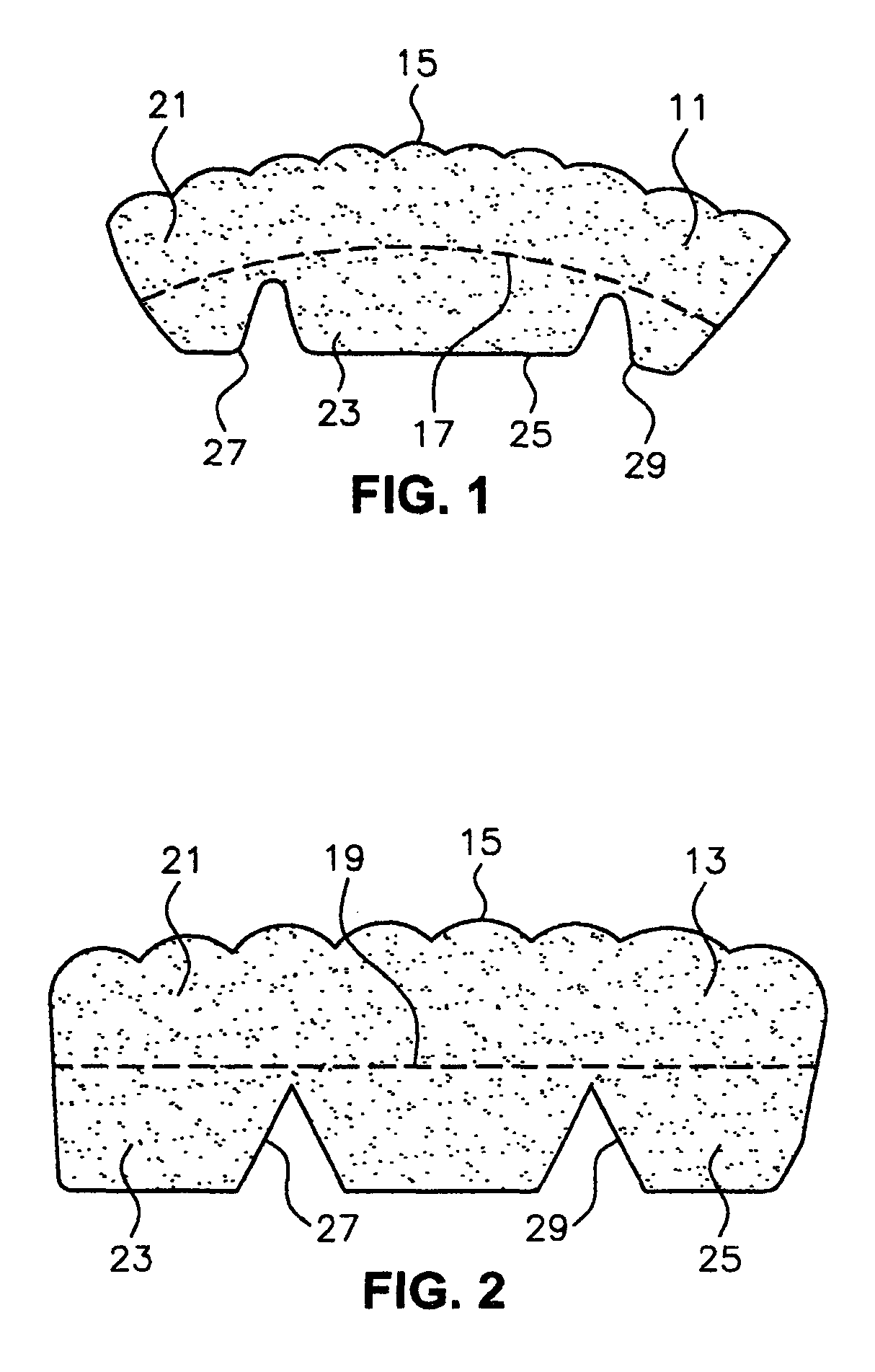 Teeth treatment device