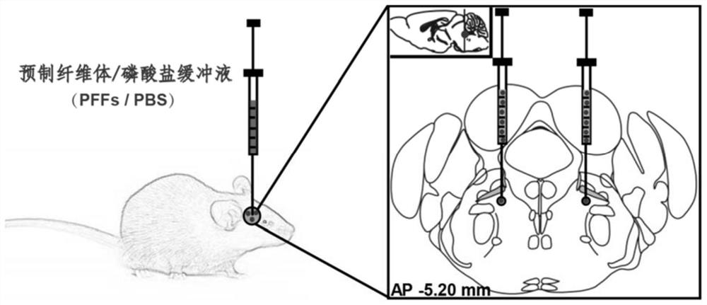 Preparation method of synuclein pathological rapid eye movement sleep behavior disorder model