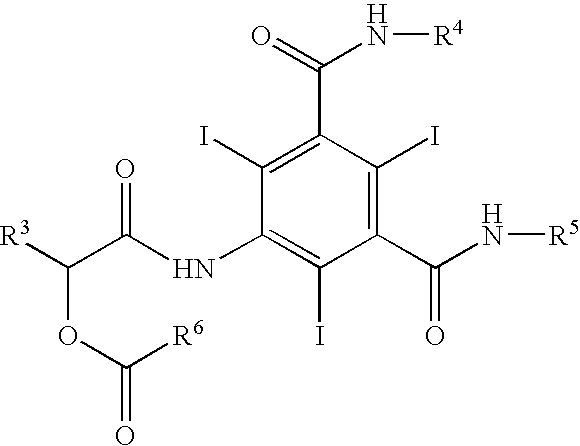 Process for the preparation of iopamidol