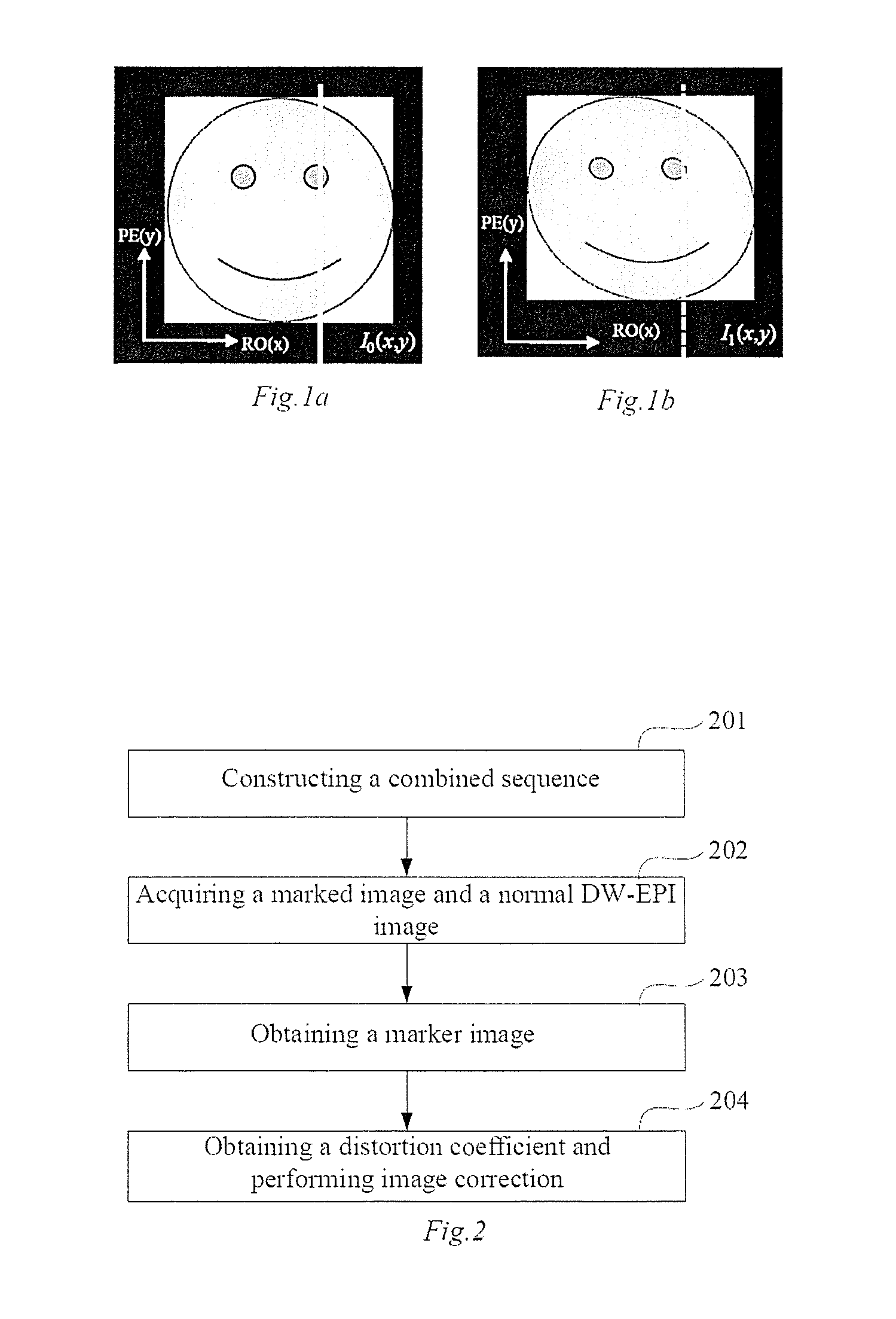 Method for correcting image distortion and system, and magnetic resonance imaging equipment