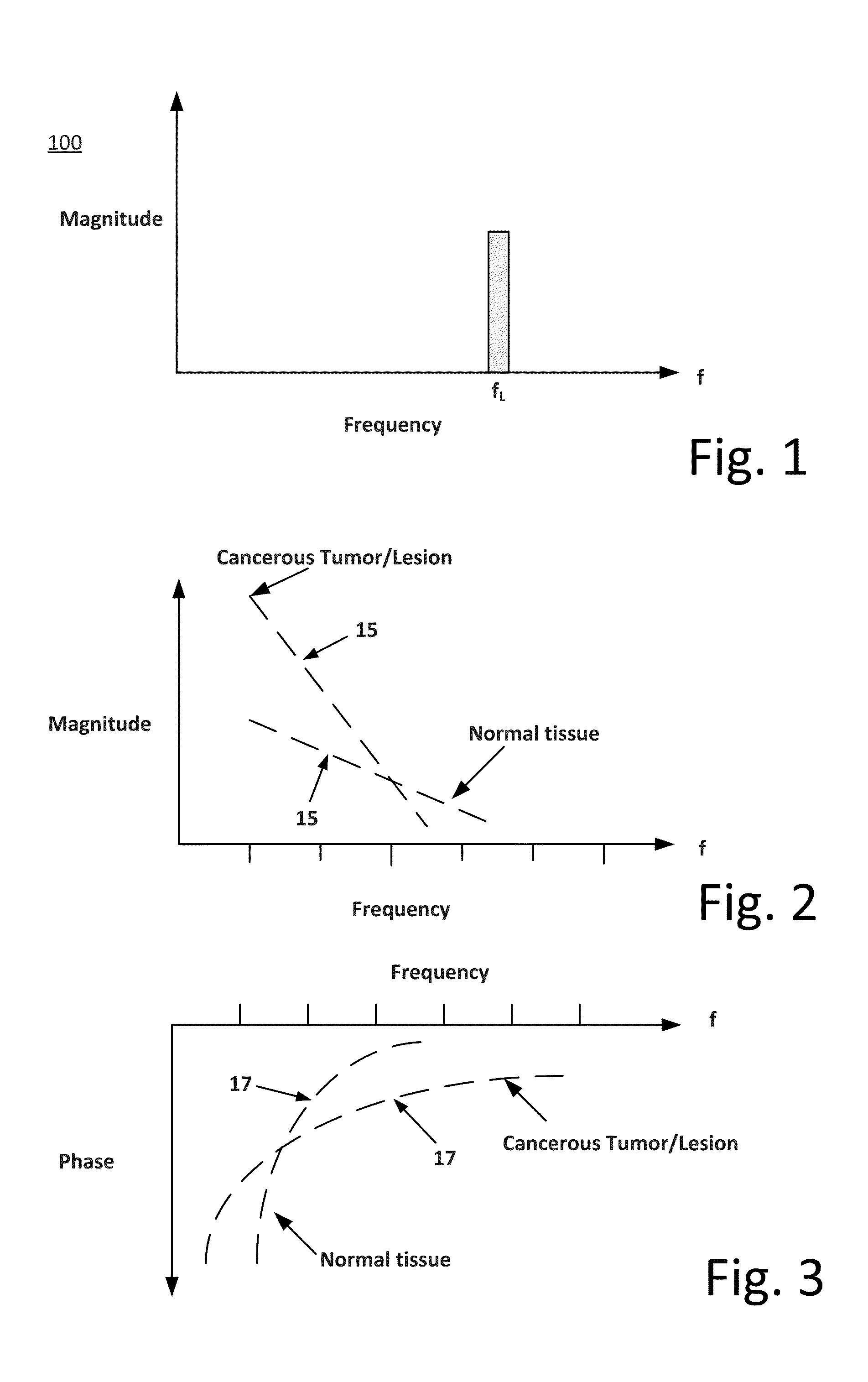 Portable cancer diagnostic device and system